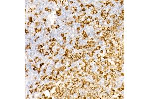 Immunohistochemistry of paraffin-embedded Human tonsil using CD74 antibody (ABIN7267759) at dilution of 1:100 (40x lens). (CD74 Antikörper)