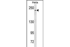 NOTCH3 Antibody  (ABIN1537680 and ABIN2843860) western blot analysis in Hela cell line lysates (35 μg/lane). (NOTCH3 Antikörper  (C-Term))