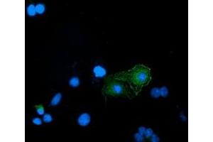 Anti-BIN3 mouse monoclonal antibody (ABIN2453899) immunofluorescent staining of COS7 cells transiently transfected by pCMV6-ENTRY BIN3 (RC203378). (BIN3 Antikörper)