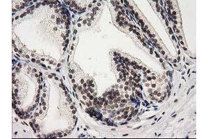 Image no. 1 for anti-Protein Kinase C, epsilon (PRKCE) antibody (ABIN1500229) (PKC epsilon Antikörper)