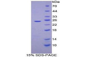 SDS-PAGE (SDS) image for Alcohol Dehydrogenase 1 (Class I) (ADH1) (AA 25-228) protein (His tag) (ABIN2123966) (ADH1 Protein (AA 25-228) (His tag))