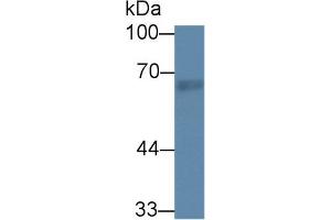 Western Blot; Sample: Rat Lung lysate; Primary Ab: 1µg/ml Rabbit Anti-Rat RTKN Antibody Second Ab: 0. (Rhotekin Antikörper  (AA 296-548))