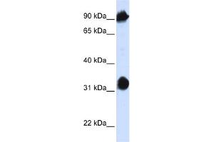 WB Suggested Anti-HSPA4 Antibody Titration:  0. (HSPA4 Antikörper  (N-Term))