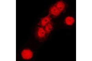 Immunofluorescent analysis of Cullin 1 staining in HeLa cells. (Cullin 1 Antikörper  (C-Term))