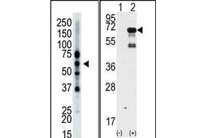 The anti-Epsin2 Pab (ABIN388977 and ABIN2839218) is used in Western blot to detect Epsin2 in mouse brain tissue lysate.