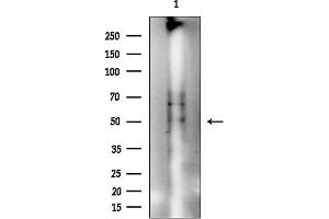 Western blot analysis of lysates from COLO205 cells(heat-shock treatment), using Phospho-NCF1/p47-phox (Ser359) Antibody at 1/1000 dilution.