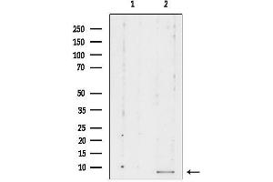 Western blot analysis of lysates from Mouse cancer, using RPL39 Antibody.