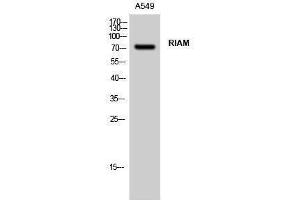 Western Blotting (WB) image for anti-Amyloid beta (A4) Precursor Protein-Binding, Family B, Member 1 Interacting Protein (APBB1IP) (Internal Region) antibody (ABIN3186762) (Amyloid beta (A4) Precursor Protein-Binding, Family B, Member 1 Interacting Protein (APBB1IP) (Internal Region) Antikörper)