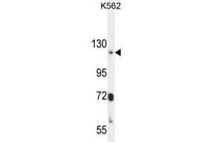 ATP8A2 Antibody (N-term) western blot analysis in K562 cell line lysates (35µg/lane). (ATP8A2 Antikörper  (N-Term))