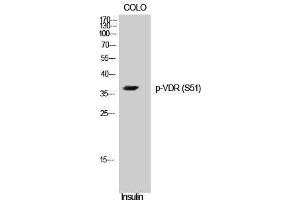 Western Blotting (WB) image for anti-Vitamin D Receptor (VDR) (pSer51) antibody (ABIN3182335)