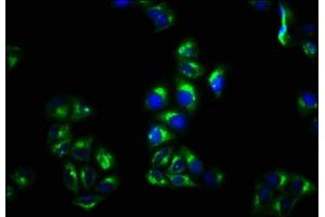 Immunofluorescence staining of Hela cells with ABIN7159461 at 1:100, counter-stained with DAPI. (CNNM4 Antikörper  (AA 589-691))