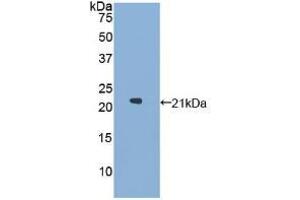 Western blot analysis of recombinant Human GaA. (GAA Antikörper  (AA 595-770))