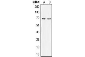 Western blot analysis of Nephrocystin 5 expression in Ramos (A), HeLa (B) whole cell lysates.