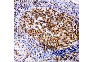 Immunohistochemistry (IHC) image for anti-Amyloid beta (A4) Precursor Protein-Binding, Family B, Member 1 Interacting Protein (APBB1IP) (AA 647-666), (C-Term) antibody (ABIN3044029)
