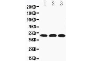 Anti-HYAL3 antibody, Western blotting Lane 1: 22RV Cell Lysate Lane 2: HELA Cell Lysate Lane 3: V20S Cell Lysate (HYAL3 Antikörper  (C-Term))