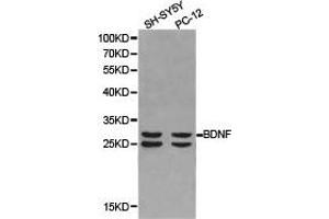 Western Blotting (WB) image for anti-Brain-Derived Neurotrophic Factor (BDNF) antibody (ABIN1871274) (BDNF Antikörper)