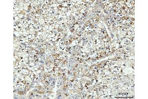 IHC analysis of HMGCS1 using anti-HMGCS1 antibody (ABIN7600928).