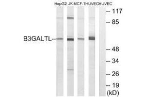 Western blot analysis of extracts from HepG2 cells, Jurkat cells, MCF-7 cells and HUVEC cells, using B3GALTL antibody. (B3GALTL Antikörper  (C-Term))