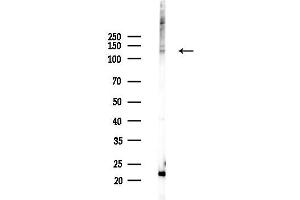 Western blot analysis of lysates from HepG2 cells(heat-shock,45 min treatment), using USP7 Antibody at 1/1000 dilution.