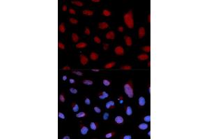 Immunofluorescence analysis of U2OS cells using TNNC1 antibody. (TNNC1 Antikörper)