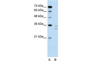 WB Suggested Anti-CD8B Antibody Titration:  0. (CD8B Antikörper  (N-Term))