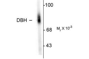 Image no. 1 for anti-Dopamine beta-Hydroxylase (Dopamine beta-Monooxygenase) (DBH) (N-Term) antibody (ABIN372612) (DBH Antikörper  (N-Term))