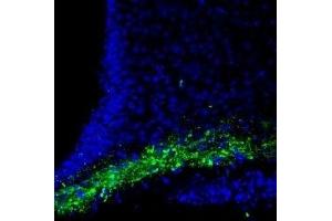 Expression of CASK in rat hypothalamus - Immunohistochemical staining of rat hypothalamus free floating frozen sections using Anti-CASK Antibody (ABIN7043020, ABIN7044534 and ABIN7044535), (1:200). (CASK Antikörper  (Intracellular))