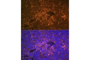 Immunohistochemistry of paraffin-embedded human esophagus using S100 Rabbit pAb (ABIN6129321, ABIN6147336, ABIN6147338 and ABIN6220958) at dilution of 1:350 (40x lens). (S100A12 Antikörper  (AA 1-92))