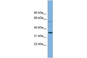 WB Suggested Anti-C3orf67 Antibody Titration: 0. (C3orf67 Antikörper  (N-Term))