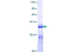 IQGAP2 Protein (AA 343-449) (GST tag)