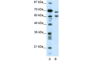 KCNK5 antibody used at 0.