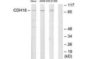 Western Blotting (WB) image for anti-Cadherin 18, Type 2 (CDH18) (AA 101-150) antibody (ABIN2889879) (CDH18 Antikörper  (AA 101-150))