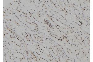 ABIN6265843 and ABIN6277620 at 1/100 staining Human kidney tissue by IHC-P. (UBE2C Antikörper  (C-Term))
