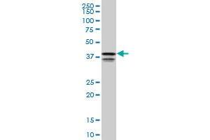 PCBP2 monoclonal antibody (M05), clone 1C7. (PCBP2 Antikörper  (AA 1-362))