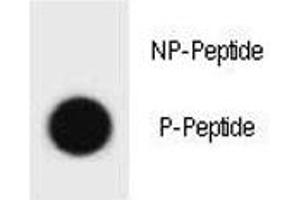 Dot blot analysis of phospho-IKKB antibody.