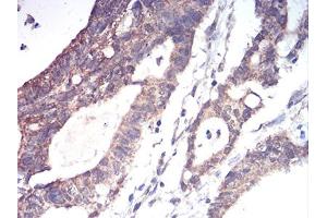 Immunohistochemistry (IHC) image for anti-Aldehyde Dehydrogenase 6 Family, Member A1 (ALDH6A1) (AA 1-195) antibody (ABIN5856297) (ALDH6A1 Antikörper  (AA 1-195))