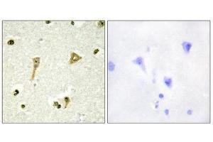 Immunohistochemistry (IHC) image for anti-TSC22 Domain Family, Member 1 (TSC22D1) (N-Term) antibody (ABIN1849646) (TSC22D1 Antikörper  (N-Term))