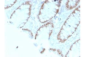 Formalin-fixed, paraffin-embedded human Colon stained with CDX2 Mouse Monoclonal Antibody (rCDX2/1690). (Rekombinanter CDX2 Antikörper  (AA 150-249))