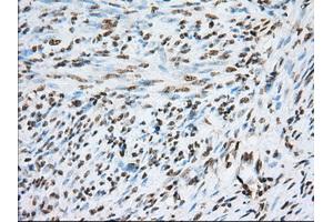 Immunohistochemical staining of paraffin-embedded liver tissue using anti-TACC3 mouse monoclonal antibody.