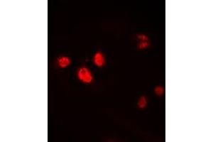 Immunofluorescent analysis of HEN1/2 staining in HEK293T cells. (HEN1/2 (Center) Antikörper)