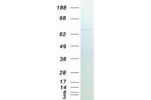 Western Blotting (WB) image for Guanylate Cyclase 1, Soluble, beta 3 (GUCY1B3) protein (Myc-DYKDDDDK Tag) (ABIN2722370)