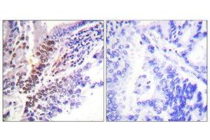 Immunohistochemistry (IHC) image for anti-GR (Internal Region), (pSer226), (pSer234), (pSer246) antibody (ABIN1847260) (GR (Internal Region), (pSer226), (pSer234), (pSer246) Antikörper)