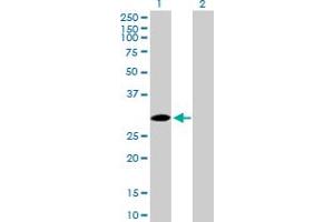 Western Blot analysis of SPSB2 expression in transfected 293T cell line by SPSB2 MaxPab polyclonal antibody. (SPSB2 Antikörper  (AA 1-263))