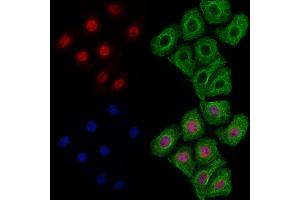 ABIN7094533 and ABIN7098582 staining Hela cells by IF/ICC.