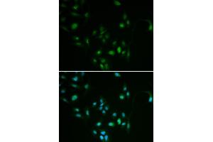 Immunofluorescence analysis of MCF7 cell using BCL2 antibody. (Bcl-2 Antikörper  (AA 81-131))