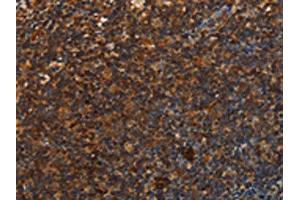 The image is immunohistochemistry of paraffin-embedded Human tonsil tissue using ABIN7131549(UPK3B Antibody) at dilution 1/25. (Uroplakin 3B Antikörper)
