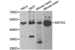 Western blot analysis of extracts of various cell lines, using SMYD2 antibody.
