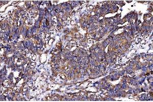 IHC analysis of HGS using anti-HGS antibody (ABIN7601206). (HGS Antikörper  (AA 3-777))
