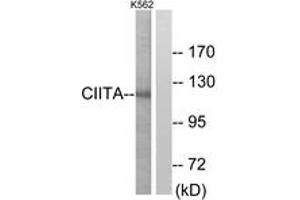 Western blot analysis of extracts from K562 cells, using CIITA Antibody.