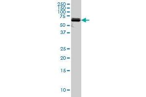 Western Blotting (WB) image for anti-3'-phosphoadenosine 5'-phosphosulfate Synthase 2 (PAPSS2) (AA 513-613) antibody (ABIN598592) (PAPSS2 Antikörper  (AA 513-613))